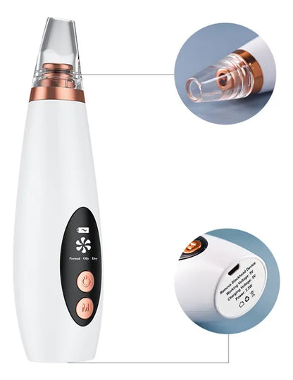 Succionador de Poros Eléctrico✨ Dile adiós a los puntos negros hoy mismo! ✨